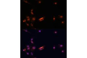Immunofluorescence analysis of C6 cells using BRC antibody (435) at dilution of 1:100. (BRCA2 Antikörper  (AA 1-300))
