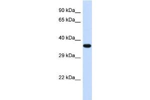 Western Blotting (WB) image for anti-Transducer of ERBB2, 2 (TOB2) (Middle Region) antibody (ABIN2500516) (TOB2 Antikörper  (Middle Region))