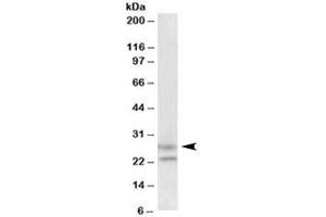 Western blot testing of human cerebellum lysate with FBXO44 antibody at 1. (FBXO44 Antikörper  (Isoform 2))