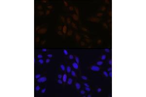 Immunofluorescence (IF) image for anti-Ets Variant 4 (ETV4) (AA 1-207) antibody (ABIN6140332)