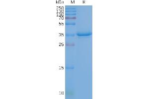 Human CD20-Nanodisc, Flag Tag on SDS-PAGE (CD20 Protein)