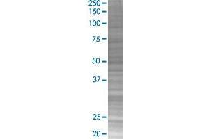 GK2 transfected lysate. (GK2 293T Cell Transient Overexpression Lysate(Denatured))