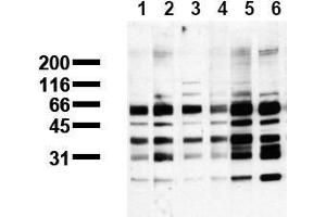 Western Blotting (WB) image for anti-Phosphoserine (phosphorylated) antibody (ABIN126861) (Phosphoserine Antikörper  (phosphorylated))