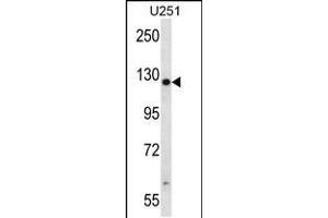 Western blot analysis in U251 cell line lysates (35ug/lane). (TTC13 Antikörper  (N-Term))