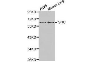 Western Blotting (WB) image for anti-Proto-oncogene tyrosine-protein kinase Src (Src) antibody (ABIN1874936) (Src Antikörper)