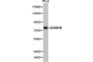 Western Blotting (WB) image for anti-Sodium Channel, Nonvoltage-Gated 1, beta (SCNN1B) antibody (ABIN1874704) (SCNN1B Antikörper)