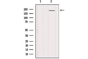 Western blot analysis of extracts from B16F10, using BRCA1 Antibody. (BRCA1 Antikörper  (Internal Region))