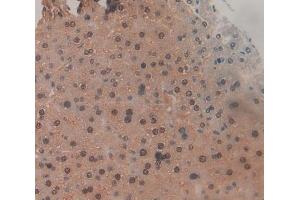 Used in DAB staining on fromalin fixed paraffin- embedded liver tissue (TNP1 Antikörper  (AA 3-53))