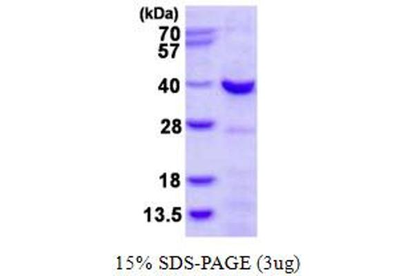 CHMP4A Protein (AA 1-265) (His tag)