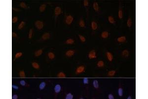 Immunofluorescence analysis of U-2 OS cells using MED25 Polyclonal Antibody at dilution of 1:100 (40x lens). (MED25 Antikörper)