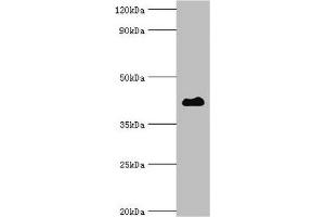 Western blot Western blot All lanes: Histone deacetylase 8 antibody at 2 μg/mL + Hela whole cell lysate Secondary Goat polyclonal to rabbit IgG at 1/10000 dilution Predicted band size: 42, 30, 18, 32, 29, 16, 17 kDa Observed band size: 42 kDa (HDAC8 Antikörper  (AA 1-377))