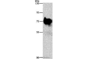 Western blot analysis of Mouse brain tissue, using SYN1 Polyclonal Antibody at dilution of 1:750 (SYN1 Antikörper)