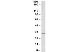 Western blot testing of A431 lysate with SNAIL antibody at 0. (SNAIL Antikörper)