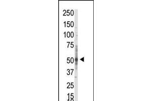 Western blot analysis of anti-PRMT3 Pab in whole HL60 cell lysate: PRMT3 was detected using purified Pab. (PRMT3 Antikörper  (N-Term))