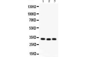 Western blot analysis of GC1q R expression in rat liver extract ( Lane 1), mouse spleen extract ( Lane 2) and MCF-7 whole cell lysates ( Lane 3). (C1QBP Antikörper  (AA 190-282))