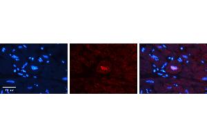 Rabbit Anti-JUNB Antibody   Formalin Fixed Paraffin Embedded Tissue: Human heart Tissue Observed Staining: Nucleus Primary Antibody Concentration: 1:100 Other Working Concentrations: N/A Secondary Antibody: Donkey anti-Rabbit-Cy3 Secondary Antibody Concentration: 1:200 Magnification: 20X Exposure Time: 0. (JunB Antikörper  (N-Term))