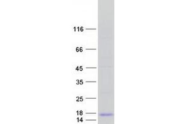 FXYD3 Protein (Transcript Variant 1) (Myc-DYKDDDDK Tag)