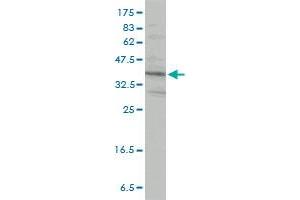 Western Blotting (WB) image for anti-Protein Kinase, Interferon-Inducible Double Stranded RNA Dependent Activator (PRKRA) (AA 1-313) antibody (ABIN563706)