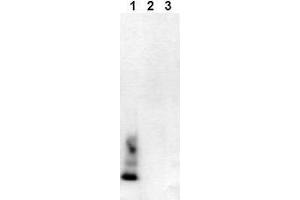 Western Blotting (WB) image for anti-Amyloid beta (Abeta) (AA 1-40), (C-Term), (N-Term) antibody (ABIN126719) (beta Amyloid Antikörper  (C-Term, N-Term))