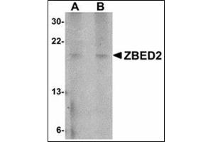 Western blot analysis of ZBED2 in A549 cell lysate with ZBED2 antibody at (A) 1 and (B) 2 µg/ml. (ZBED2 Antikörper  (N-Term))