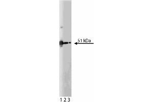 Western blot analysis of PKA[RIIalpha] on K562 lysate. (PKA RIIalpha (AA 1-404) Antikörper)