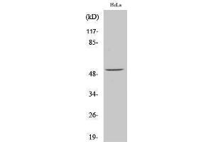 Western Blotting (WB) image for anti-Activating Transcription Factor 2 (ATF2) (pSer62) antibody (ABIN3179390) (ATF2 Antikörper  (pSer62))