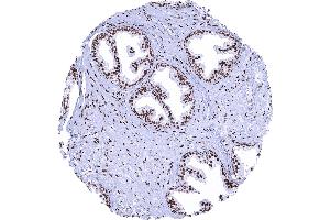 Prostate A strong nuclear AR immunostaining is seen in stromal and epithelial cells of the prostate. (Rekombinanter Androgen Receptor Antikörper  (AA 1-100))