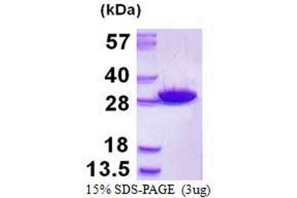 GSTM5 Protein (His tag)