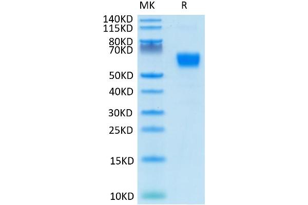 CD28 Protein (CD28) (AA 19-152) (Fc Tag)