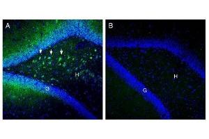 Expression of SLC25A12 in rat hippocampus. (SLC25A12 Antikörper  (Intracellular, N-Term))