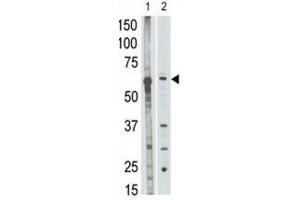 Western Blotting (WB) image for anti-Matrix Metallopeptidase 25 (MMP25) antibody (ABIN5022339) (MMP25 Antikörper)