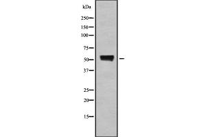 Western blot analysis of A1Up using COLO205 whole cell lysates (UBQLN4 Antikörper  (Internal Region))