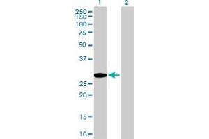 Western Blot analysis of GCLM expression in transfected 293T cell line by GCLM MaxPab polyclonal antibody. (GCLM Antikörper  (AA 1-274))