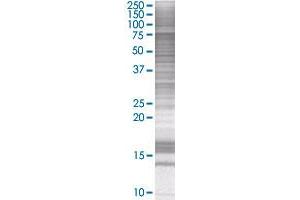 GAS6 transfected lysate. (GAS6 293T Cell Transient Overexpression Lysate(Denatured))