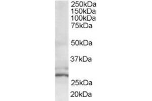 Western Blotting (WB) image for anti-HIV-1 Tat Interactive Protein 2, 30kDa (HTATIP2) (N-Term) antibody (ABIN2466379) (HIV-1 Tat Interactive Protein 2, 30kDa (HTATIP2) (N-Term) Antikörper)