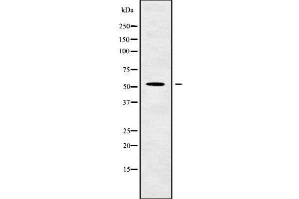 GCNT4 Antikörper  (Internal Region)