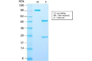 SDS-PAGE (SDS) image for anti-alpha-Methylacyl-CoA Racemase (AMACR) (AA 297-394) antibody (ABIN6939432)