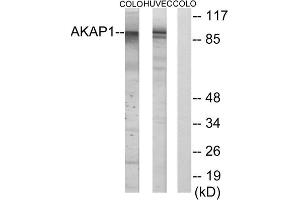 Western blot analysis of extracts from HUVEC cells and COLO cells, using AKAP1 antibody. (AKAP1 Antikörper  (Internal Region))