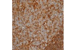 Immunohistochemistry (IHC) image for anti-CD44 (CD44) antibody (ABIN180800) (CD44 Antikörper)