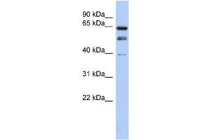 Western Blotting (WB) image for anti-MYST Histone Acetyltransferase 2 (MYST2) antibody (ABIN2457900) (MYST2 Antikörper)