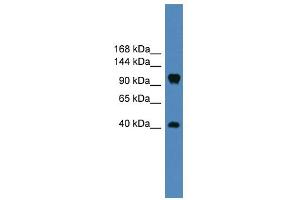 WB Suggested Anti-CNTN1 Antibody Titration: 0. (Contactin 1 Antikörper  (Middle Region))