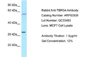 Western Blotting (WB) image for anti-Transforming Growth Factor beta Regulator 4 (TBRG4) (C-Term) antibody (ABIN971852) (TBRG4 Antikörper  (C-Term))