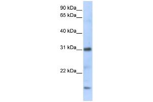 WB Suggested Anti-CXCL16 Antibody Titration:  0. (CXCL16 Antikörper  (C-Term))