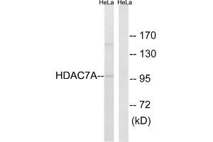 Western blot analysis of extracts from HeLa cells, using HDAC7A (epitope around residue 155) antibody. (HDAC7 Antikörper  (Ser155))