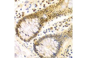 Immunohistochemistry of paraffin-embedded Human colon using DKC1 antibody at dilution of 1:100 (x400 lens). (DKC1 Antikörper)