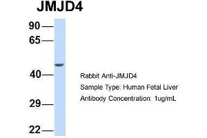 Host:  Rabbit  Target Name:  JMJD4  Sample Type:  Human Fetal Liver  Antibody Dilution:  1. (JMJD4 Antikörper  (N-Term))