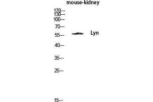 Western Blot (WB) analysis of Mouse Kidney lysis using Lyn antibody. (LYN Antikörper  (Ser78))