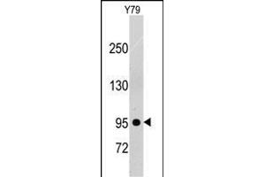 Western blot analysis of anti-PDGFRB Pab (ABIN392036 and ABIN2841804) in Y79 cell line lysates (35 μg/lane). (PDGFRB Antikörper)