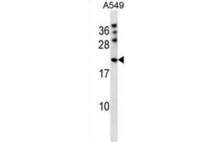 Western Blotting (WB) image for anti-M-Phase phosphoprotein 6 (MPHOSPH6) antibody (ABIN2998749) (MPHOSPH6 Antikörper)