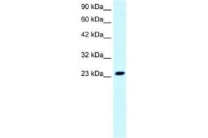Human Jurkat; WB Suggested Anti-FLJ11730 Antibody Titration: 0. (MEAF6 Antikörper  (N-Term))